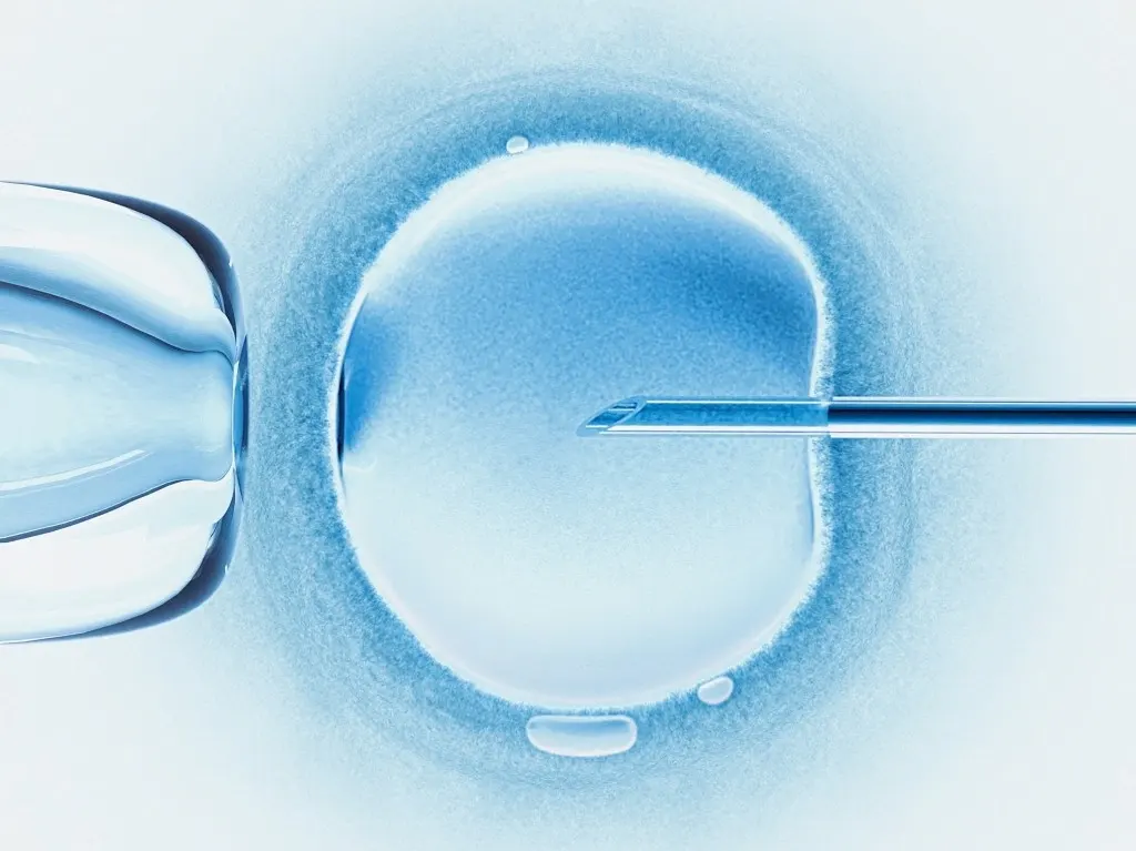 IVF success rate in Madurai